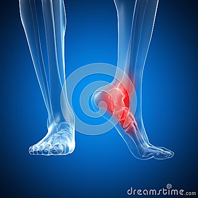 Highlighted ankle Cartoon Illustration