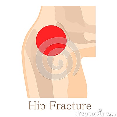 Hip fracture icon, cartoon style Vector Illustration