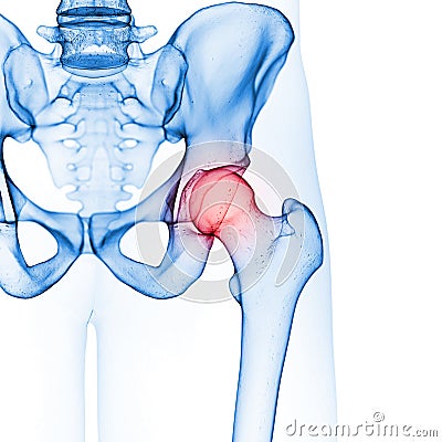 The hip joint Cartoon Illustration