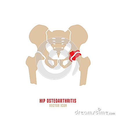 Hip osteoarthritis icon Vector Illustration