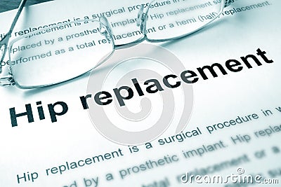 Hip replacement written on a page. Stock Photo