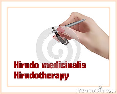 Hirudotherapy. Treatment with leeches. Vector Illustration