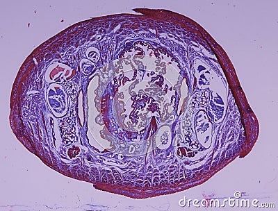 Histological cross section through a leech Stock Photo