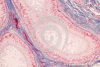 Histological Epididymis and Testis human cells under microscope. Stock Photo