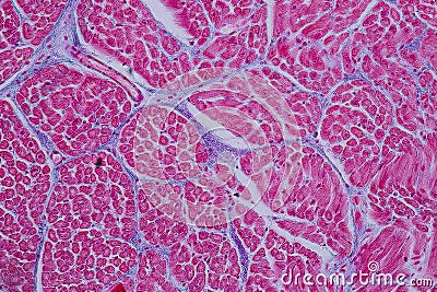 Histological sample Heart muscle Tissue under the microscope. Stock Photo