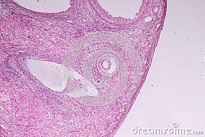 Histological sample Ovary of rabbit Tissue under the microscope. Stock Photo