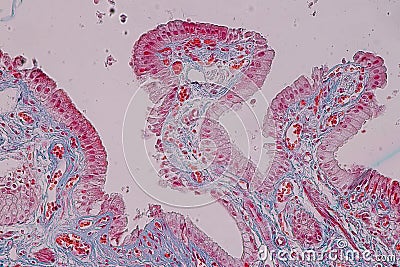 Histological sample Simple columnar epithelium Tissue under the microscope. Stock Photo