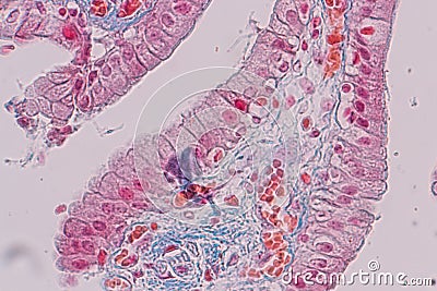 Histological sample Simple columnar epithelium Tissue under the microscope. Stock Photo