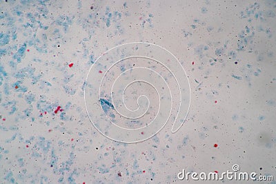 Histological sample Squamous epithelial cells under microscope. Stock Photo