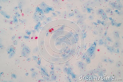 Histological sample Squamous epithelial cells under microscope. Stock Photo