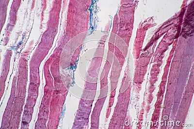 Histological sample Striated Skeletal muscle of mammal Tissue under the microscope. Stock Photo