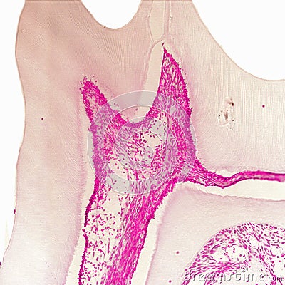 Histological section of molar tooth. Stock Photo