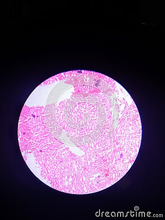 Histological Slide of Liver seen from microscope. Stock Photo