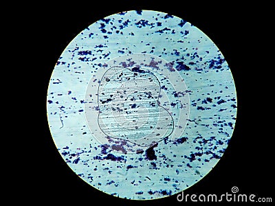 A histological slide of a tissue sample. Close microscopic view. Histopathology Stock Photo