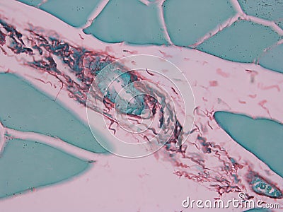 Histology of Collagen & Muscle Stock Photo