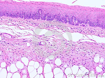 Histology of epiglottis human tissue Stock Photo