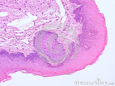 Histology of epiglottis human tissue Stock Photo