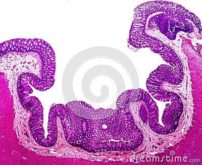 Histology of human appendix, micrograph showing Crypts of Lieberkuhn Stock Photo