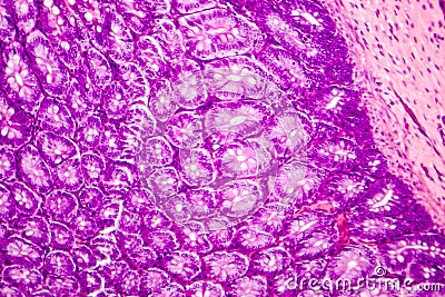 Histology of human appendix, micrograph showing Crypts of Lieberkuhn Stock Photo