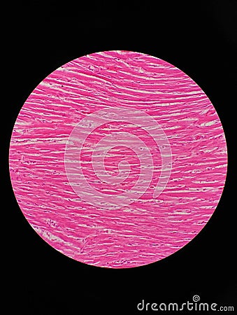 Histology of human cardiac muscle Stock Photo