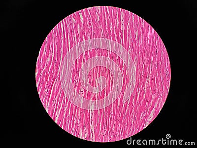 Histology of human cardiac muscle Stock Photo