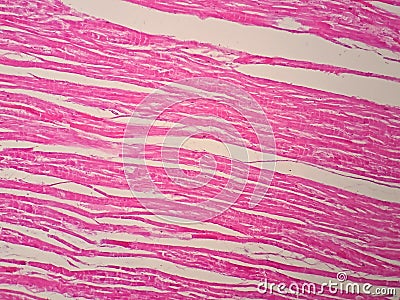 Histology of human cardiac muscle Stock Photo