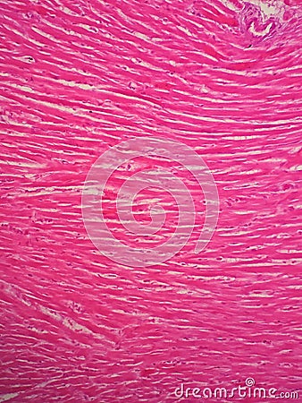 Histology of human cardiac muscle Stock Photo