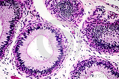 Histology of human epididymis tissue Stock Photo