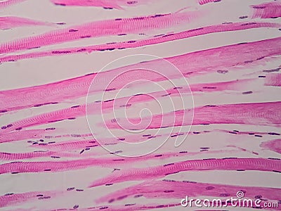 Histology of human skeletal muscle Stock Photo