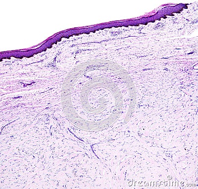 Histology of human tissue, show skin as seen under the microscope Stock Photo