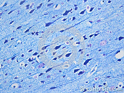 Histology of the normal brain using LFB/CV Stock Photo