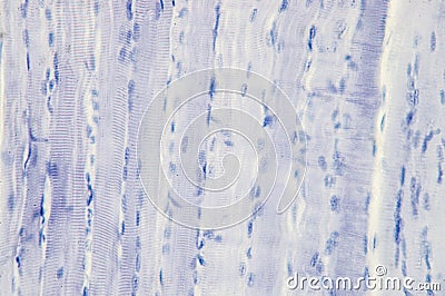 Histology of skeletal muscle Stock Photo