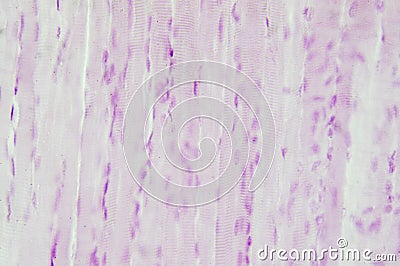 Histology of skeletal muscle Stock Photo