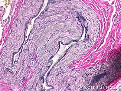 Histology of the Uterus Stock Photo