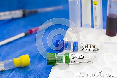HIV and aids infection test, doctors face and hand holding tube with blood on the blue background Stock Photo