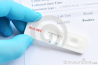 HIV positive test result Stock Photo