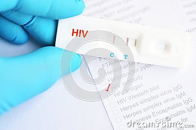 HIV positive test result Stock Photo