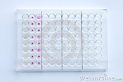 HIV testing Stock Photo