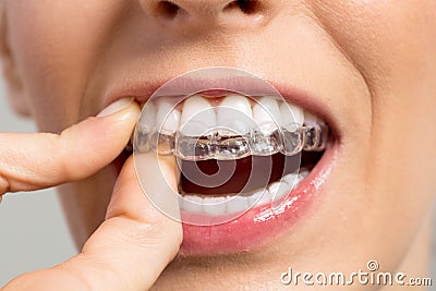 Holding Invisible braces Stock Photo