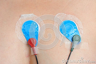 Holter Heart Monitor Stock Photo