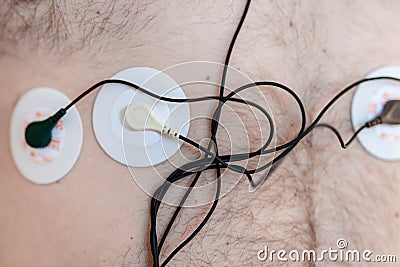 Holter monitor device on human male body. Daily cardiogram examination. Excess fat person. High risk of cardial disease Stock Photo