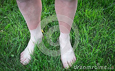 Pair of male legs sun burned to the ankle Stock Photo