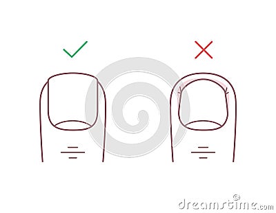 How to trim your toenails correctly Vector Illustration