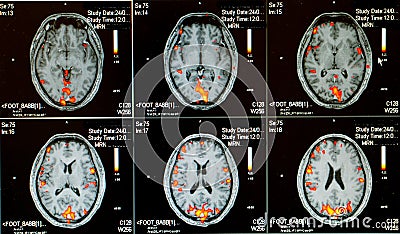 Human active brain Stock Photo