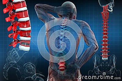 Anatomical vision back pain. Spine anatomy. 3D illustration Stock Photo