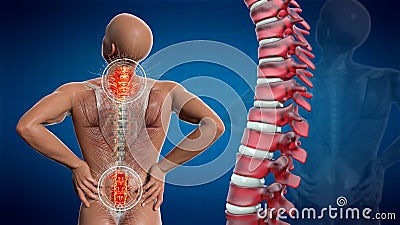 Anatomical vision back pain. Spine anatomy. 3D illustration Stock Photo