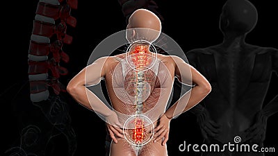 Anatomical vision back pain. Spine anatomy. 3D illustration Stock Photo