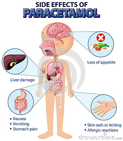 Human anatomy diagram cartoon style of paracetamol side effects Vector Illustration