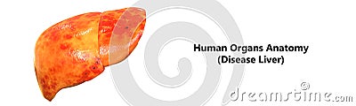 Human Body Organs Anatomy Disease Liver Stock Photo