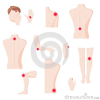 Human body parts with pain zones, vector flat isolated illustration Vector Illustration